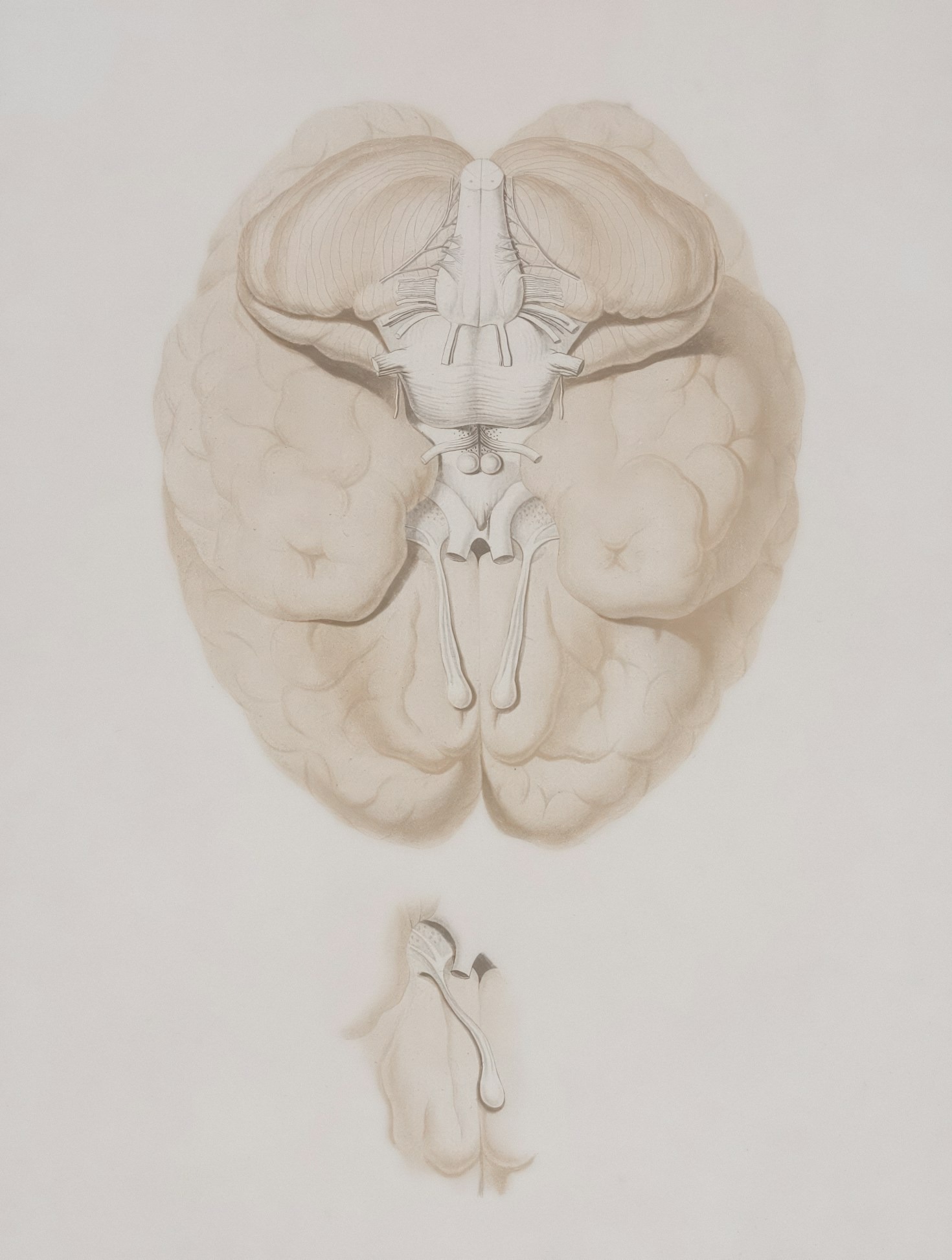 How Neurodiversity Enriches Our World